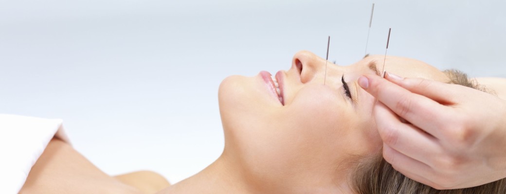 Acupuncture therapy - alternative medicine