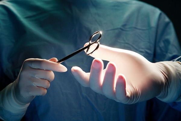 vasectomie
