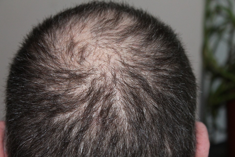 hair-248049_960_720