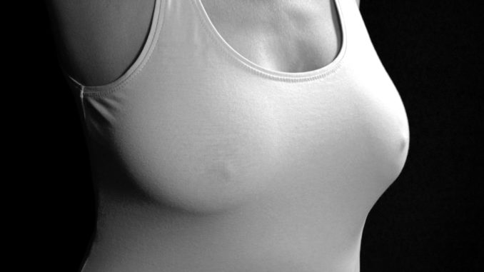 Qu’est-ce que la mastopexie Qu’est-ce que la mastopexie