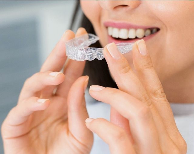 alignement des dents