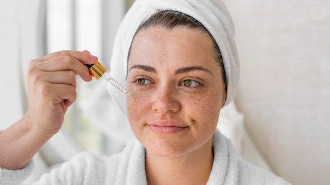 hyperpigmentation